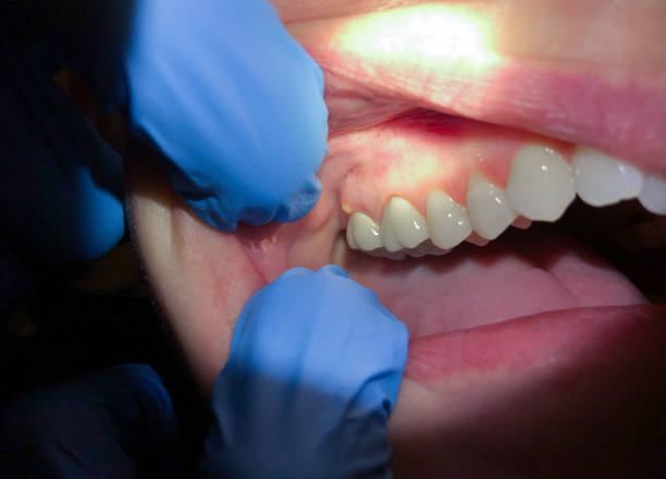 Best Emergency Dentist for Knocked-Out Tooth in , IN